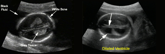 Real-Time B-Mode Ultrasound